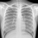 印第安纳大学胸部X光诊断数据集