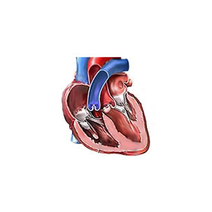 UCI-心脏病数据集