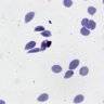 带标注的疟疾细胞图片数据集