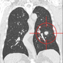 LUNA16肺部CT扫描图片数据集